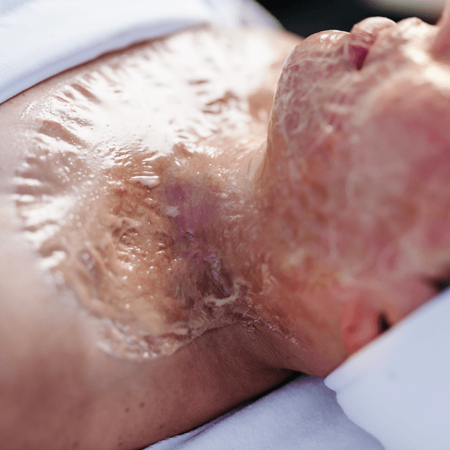 Firming Peptide at The Glow Lab in Hawthorne, NJ